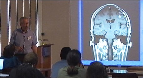 Diagnostic problems in brain tumor Imaging by MRΙ