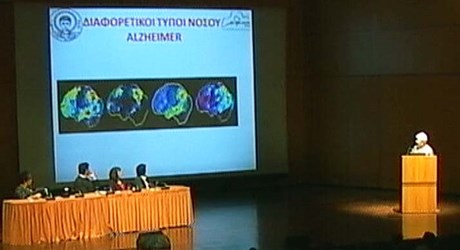 Νέα δεδομένα σχετικά με την παθογένεια και τη θεραπεία της νόσου Alzheimer Νέα δεδομένα σχετικά με την παθογένεια και τη θεραπεία της νόσου Alzheimer
